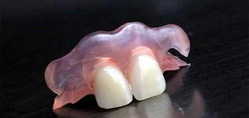 活动假牙取下来的视频,直观体验牙齿护理新视角